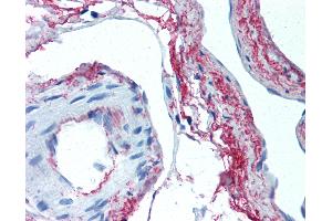 Anti-Elastin antibody IHC of human skeletal muscle, vessels. (Elastin anticorps)
