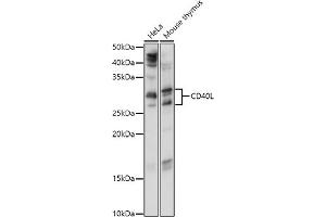 Western blot analysis of extracts of various cell lines, using CD40L antibody (ABIN6133614, ABIN6138190, ABIN6138191 and ABIN6216826) at 1:1000 dilution. (CD40 Ligand anticorps  (AA 79-129))