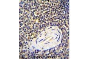 Immunohistochemistry (IHC) image for anti-ArfGAP with Coiled-Coil, Ankyrin Repeat and PH Domains 1 (ACAP1) antibody (ABIN2996040) (ACAP1 anticorps)