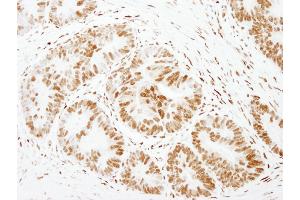 anti-Forkhead Box K1 (Foxk1) (AA 683-733) antibody
