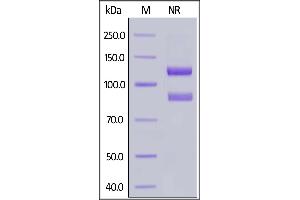 Human ITGAIIb&ITGB3 Heterodimer Protein, His Tag&Tag Free on  under ing (NR) condition.