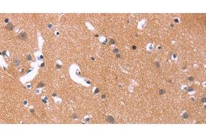 Immunohistochemistry of paraffin-embedded Human brain using MAPK11 Polyclonal Antibody at dilution of 1:30 (MAPK11 anticorps)