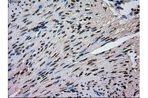 Immunohistochemical staining of paraffin-embedded pancreas tissue using anti-MAPK1mouse monoclonal antibody. (ERK2 anticorps)