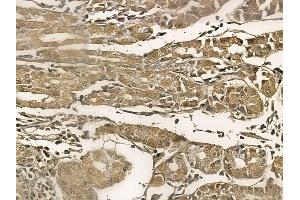 KLHL4 Mouse Monoclonal Antibody at 1/100 staining human normal gastric tissue by IHC-P. (Kelch-Like 4 anticorps)