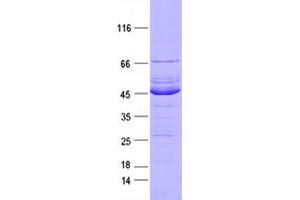 Validation with Western Blot