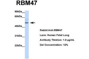 Host: Rabbit  Target Name: RBM47  Sample Tissue: Human Fetal Lung  Antibody Dilution: 1.