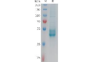 Interleukin 25 (IL25) (AA 33-177) protein (Fc Tag)