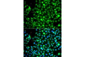Immunofluorescence analysis of A549 cells using NME2 antibody.