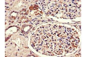 Immunohistochemistry of paraffin-embedded human kidney tissue using ABIN7175380 at dilution of 1:100 (FLT1 anticorps  (AA 1048-1328))