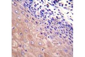 GCLC antibody immunohistochemistry analysis in formalin fixed and paraffin embedded human esophageal carcinoma.