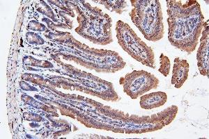 IHC analysis of ApoER2/LRP8 using anti-ApoER2/LRP8 antibody (ABIN7601752).