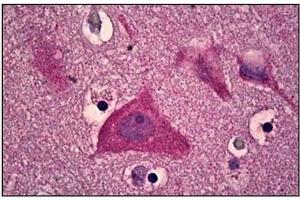 Human Brain, Cortex: Formalin-Fixed, Paraffin-Embedded (FFPE)