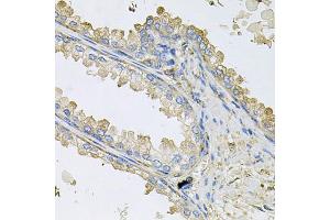 Immunohistochemistry of paraffin-embedded human prostate using PPIC antibody. (PPIC anticorps)