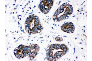Anti- CYP1A1 Picoband antibody,IHC(P) IHC(P): Human Mammary Cancer Tissue