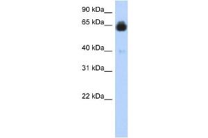 IGFALS antibody used at 1 ug/ml to detect target protein. (IGFALS anticorps  (Middle Region))