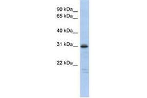 Image no. 1 for anti-Homeobox D9 (HOXD9) (AA 143-192) antibody (ABIN6742472) (HOXD9 anticorps  (AA 143-192))