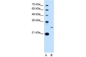 Tetraspanin 15 antibody used at 1 ug/ml to detect target protein.