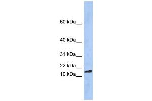WB Suggested Anti-TAL2 Antibody Titration:  0. (TAL2 anticorps  (Middle Region))