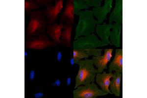 ABIN6264142 and ABIN6266623 staining  cells by IF/ICC.