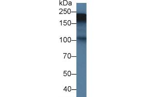 Detection of TNC in Rat Placenta lysate using Polyclonal Antibody to Tenascin C (TNC) (TNC anticorps  (AA 513-621))