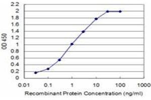 Detection limit for recombinant GST tagged SMG1 is approximately 0. (SMG1 anticorps  (AA 2922-3031))