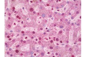 Anti-CIDEA / CIDE-A antibody IHC staining of human liver. (CIDEA anticorps  (AA 181-209))