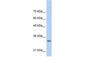 WB Suggested Anti-MAFB Antibody Titration:  0. (MAFB anticorps  (N-Term))