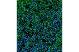 Immunofluorescent analysis of 4 % paraformaldehyde-fixed, 0.