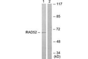 Western blot analysis of extracts from A549 cells, treated with EGF 200ng/ml 30', using DRP-2 (Ab-514) Antibody. (DRP2 anticorps  (AA 480-529))