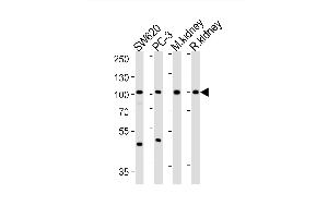 Western blot analysis of lysates from SW620, PC-3 cell line, mouse kidney, rat kidney tissue lysate (from left to right), using SUPV3L1 Antibody at 1:1000 at each lane. (SUPV3L1 anticorps  (N-Term))