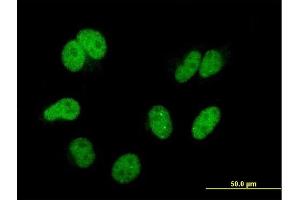 Immunofluorescence of monoclonal antibody to CAND1 on HeLa cell. (CAND1 anticorps  (AA 1-100))