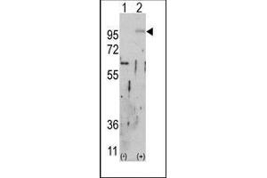 Western blot analysis of FGFR2 (arrow) using rabbit polyclonal FGFR2 Antibody. (FGFR2 anticorps)