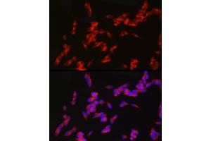 Immunofluorescence analysis of SH-SY5Y cells using nNOS Rabbit mAb (ABIN1680436, ABIN1680435, ABIN7101483 and ABIN7101484) at dilution of 1:100 (40x lens). (NOS1 anticorps)