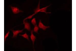 ABIN6267288 staining MDA-MB-435 by IF/ICC.