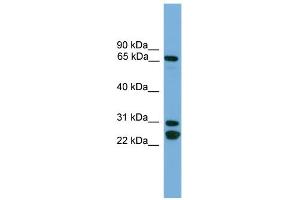 WB Suggested Anti-DNAI2 Antibody Titration:  0. (DNAI2 anticorps  (N-Term))
