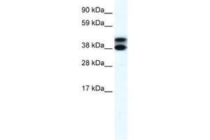 Western Blotting (WB) image for anti-Tripartite Motif Containing 13 (TRIM13) antibody (ABIN2460875) (TRIM13 anticorps)