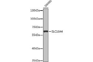 Western blot analysis of extracts of SW480 cells, using SLC16 Rabbit pAb (ABIN7270403) at 1:1000 dilution. (SLC16A4 anticorps  (AA 250-350))