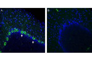 Expression of NMUR1 in rat cerebellum. (Neuromedin U Receptor 1 (NMUR1) Peptide)