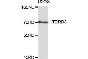 Western blot analysis of extracts of U2OS cells, using TDRD3 antibody (ABIN5973573) at 1/1000 dilution. (TDRD3 anticorps)