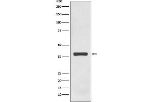 Western blot analysis of AMPK gamma 1 expression in HEK293 cell lysate.