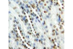 IHC-P analysis of Kidney tissue, with DAB staining. (GATA2 anticorps  (AA 175-480))