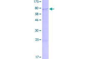 Image no. 1 for HERV-FRD Provirus Ancestral Env Polyprotein (Herv-frd) (AA 1-538) protein (GST tag) (ABIN7540286)