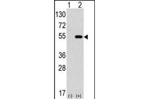 ATG4C anticorps  (AA 167-196)