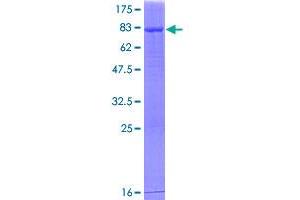 Image no. 1 for Aldehyde Dehydrogenase 1 Family, Member A2 (ALDH1A2) (AA 1-480) protein (GST tag) (ABIN1344818)