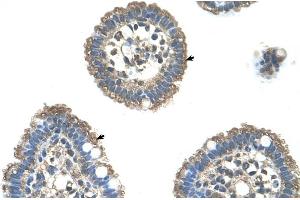 Human Intestine (UBE2L3 anticorps  (C-Term))