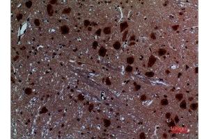 Immunohistochemistry (IHC) analysis of paraffin-embedded Rat Brain, antibody was diluted at 1:100.