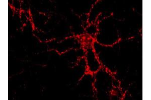Immunocytochemistry on PFA fixed cultured hippocampus neurons.