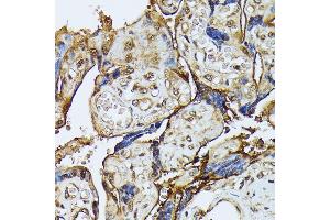 Immunohistochemistry of paraffin-embedded human placenta using D antibody (ABIN7266712) at dilution of 1:100 (40x lens). (DAPK3 anticorps  (AA 1-100))
