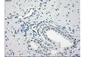 Immunohistochemical staining of paraffin-embedded endometrium tissue using anti-FCGR2A mouse monoclonal antibody. (FCGR2A anticorps)