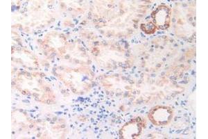 IHC-P analysis of Human Kidney Tissue, with DAB staining. (HSPD1 anticorps  (AA 172-343))